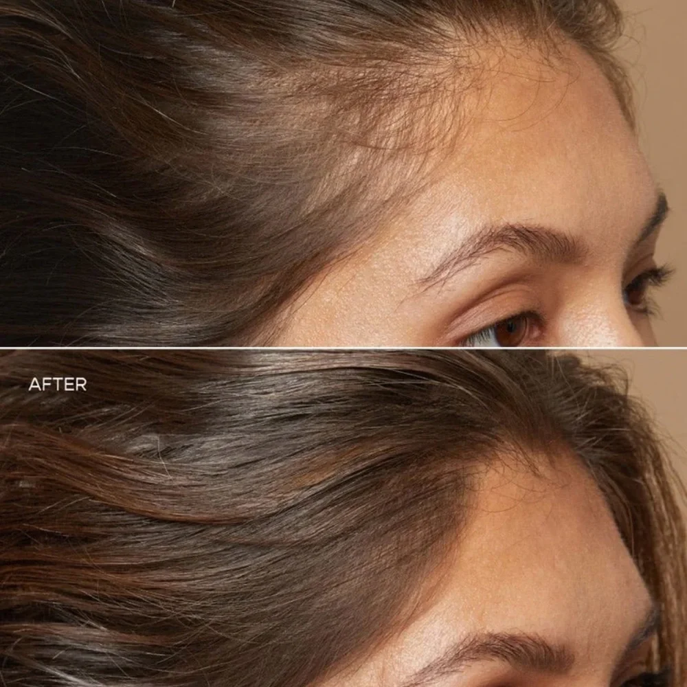 Vegamour GRO Hair Serum - Picture 3 of 10